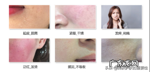 快速修复敏感肌肤的6个小妙招 什么化妆品不过敏补水效果好