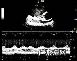 犬扩张型肥厚性心肌病