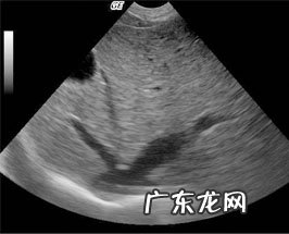 犬扩张型肥厚性心肌病