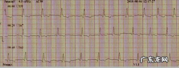 犬扩张型肥厚性心肌病