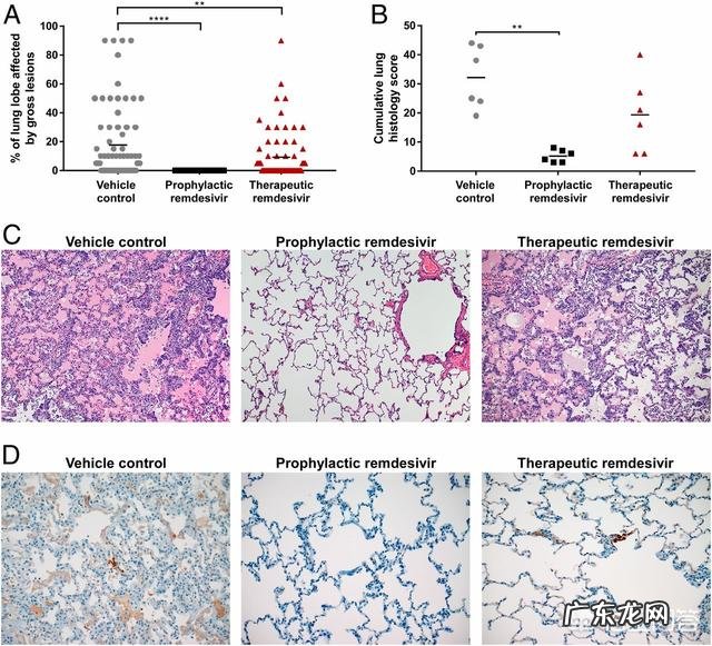 世卫:目前只有一种药可能有效,就是瑞德西韦。是暗示其他无效吗