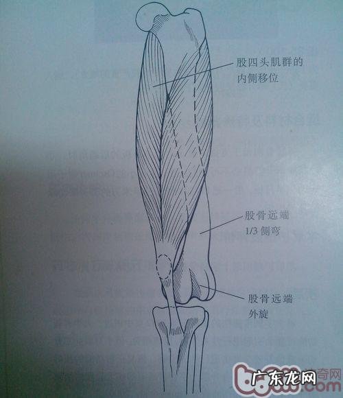 探讨犬髌骨脱位