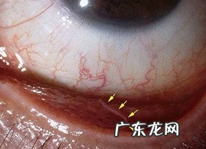 春天小狗狗易患什么裂头蚴?