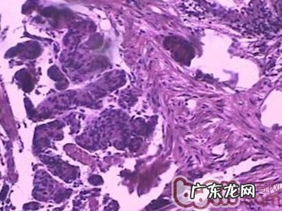 探讨小宠物原性人畜共患病