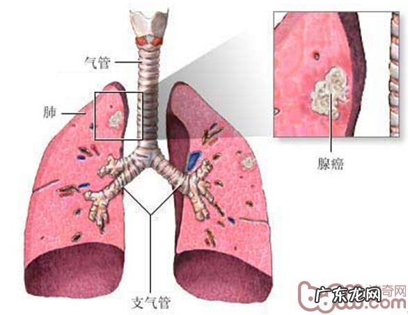 探讨小宠物原性人畜共患病