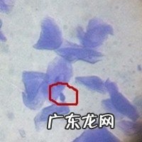 五 犬常见的皮肤病马拉色菌过敏性皮炎