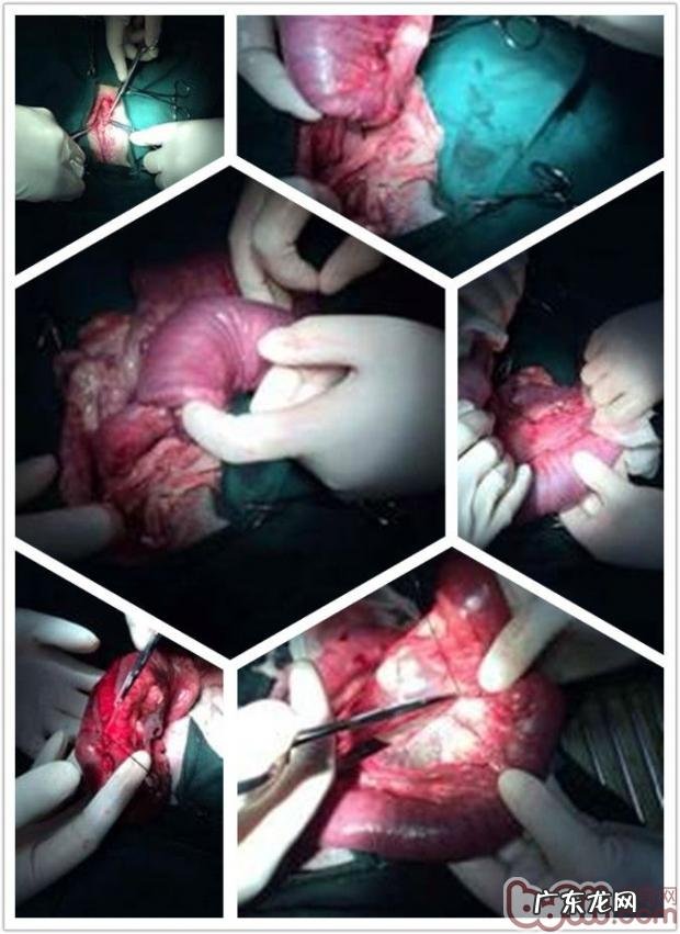 一例德牧肠套叠的确诊与医治全过程