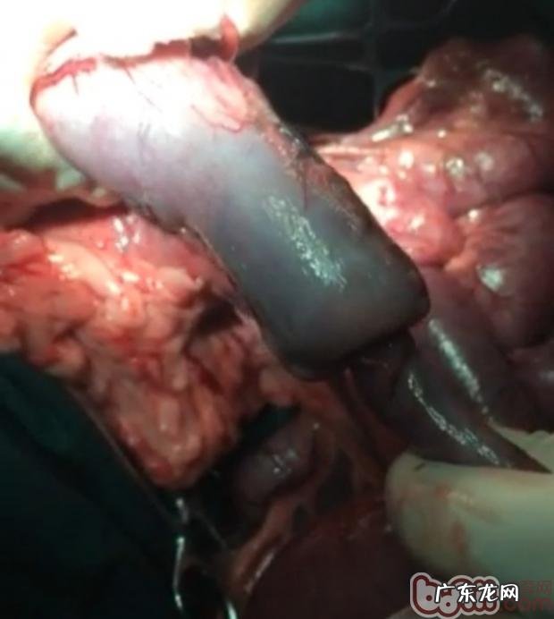 一例德牧肠套叠的确诊与医治全过程