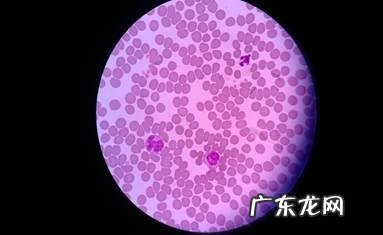 一例蜱虫叮咬的病例分析