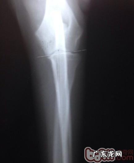 哪一个狗的腕关节更强?—犬腕关节发育不全