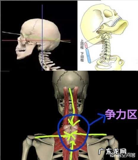 颈后大包,富贵包=夺命包,生命走向倒计时,如何防冶