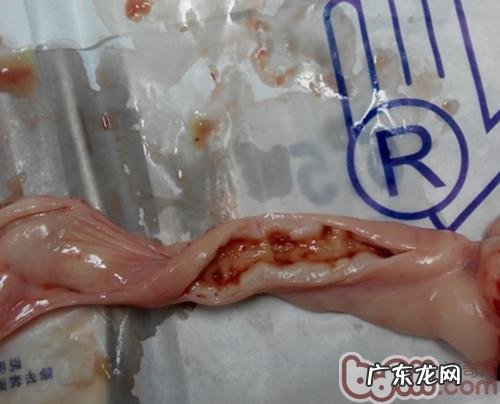 一例犬子宫蓄脓和子宫肌瘤的医治