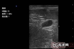 犬猫孑宫蒂蓄脓症与病例分享