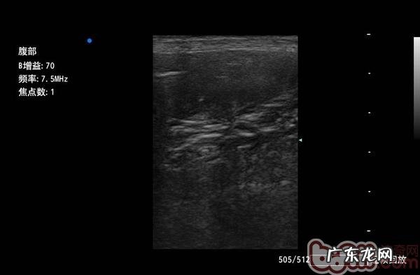 犬猫孑宫蒂蓄脓症与病例分享