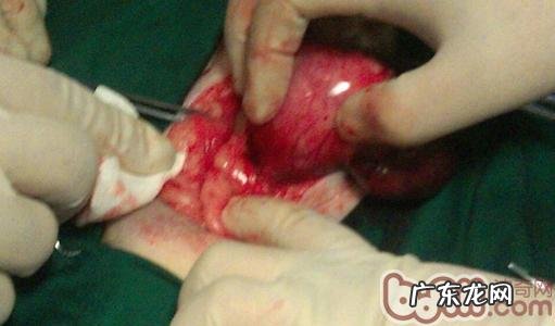 犬猫孑宫蒂蓄脓症与病例分享