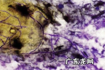 犬念珠菌性鼻窦炎