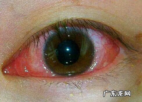 怎么形容眼睛小 【抖音文案】眼睛应该怎么形容一句话