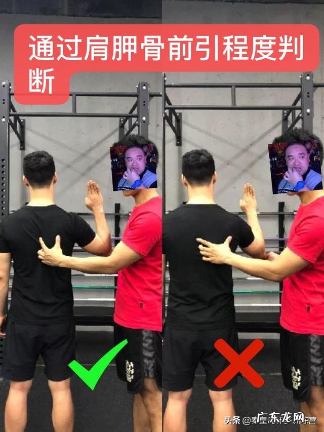 圆肩,驼背,富贵包,要怎样通过运动来调节呢