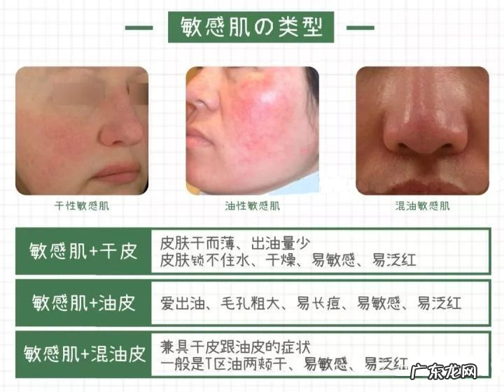 秋冬季五大肌肤护理详解 冬季护肤的正确步骤是什么