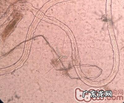 犬疥螨和细菌混和传染性皮肤疾病