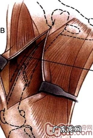 一例犬股骨头技术骨干骨折治疗全纪录