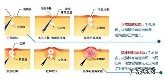 去角质的小窍门简单有效 面部去角质有必要吗