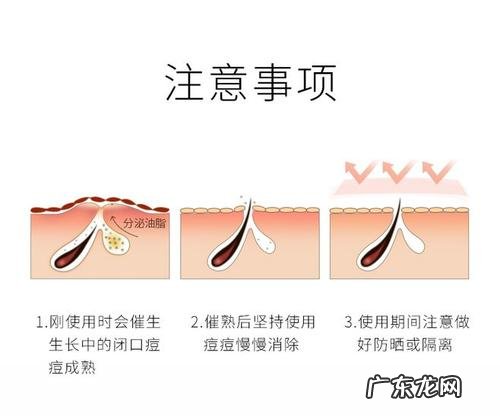 去角质的小窍门简单有效 面部去角质有必要吗