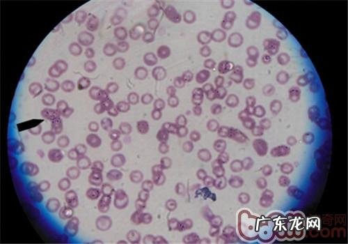 夏天裂头蚴之——蜱