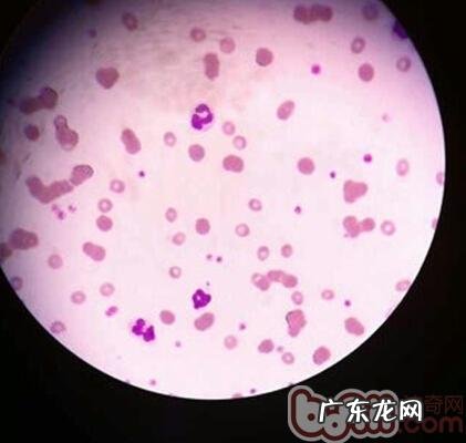 犬圆葱中毒了的医治