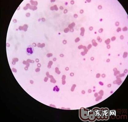 犬圆葱中毒了的医治