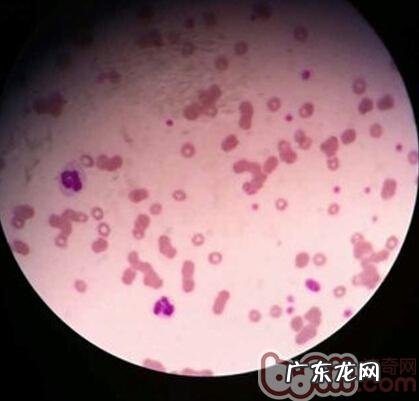 犬圆葱中毒了的医治