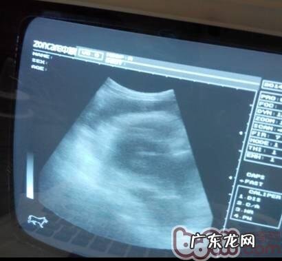 一例杜宾犬的胸腔积水的病例分析