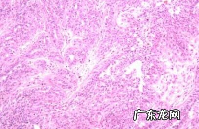 犬乳腺肿瘤的预防方式