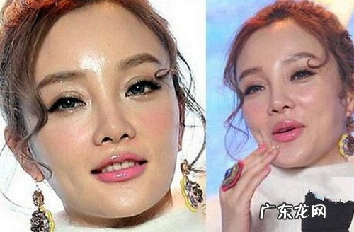 盘点娱乐圈10位被整容毁掉的女星 娱乐圈整容的女明星有哪些