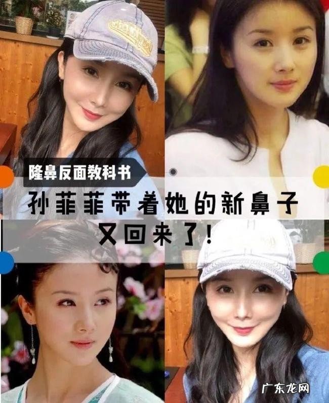 盘点娱乐圈10位被整容毁掉的女星 娱乐圈整容的女明星有哪些