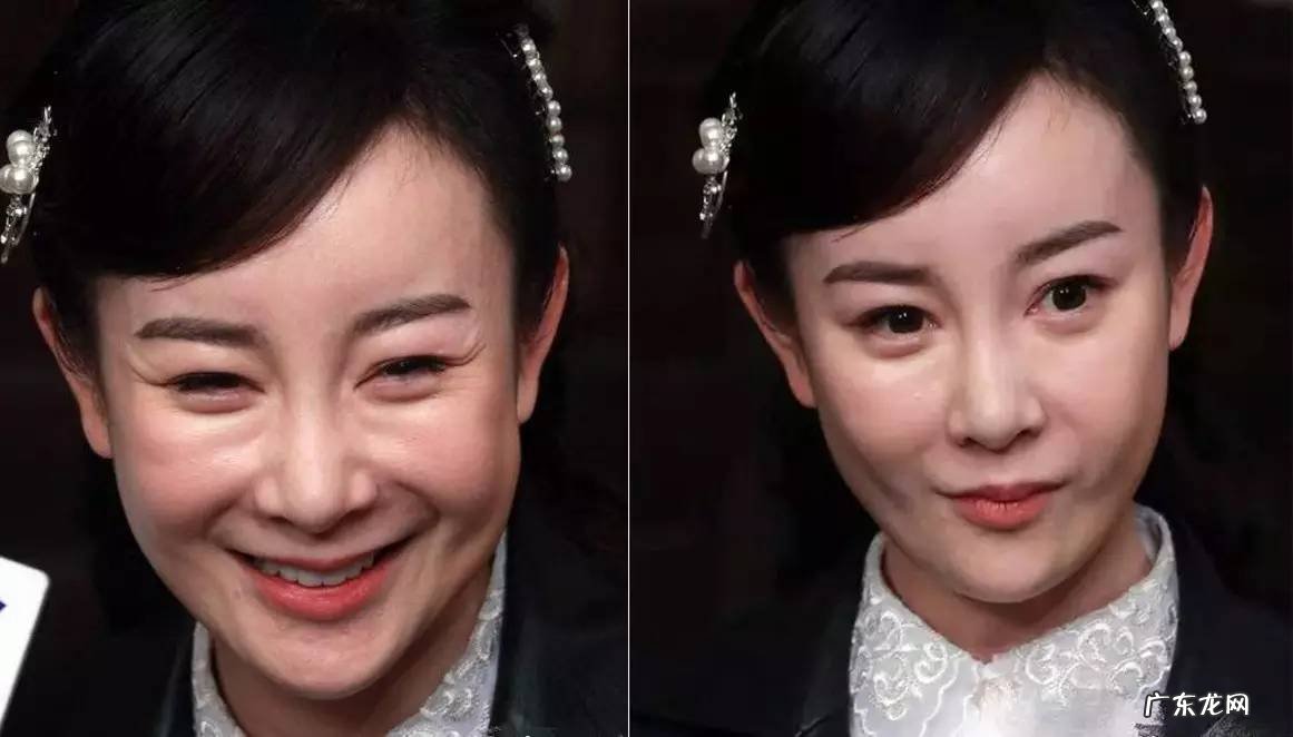 盘点娱乐圈10位被整容毁掉的女星 娱乐圈整容的女明星有哪些