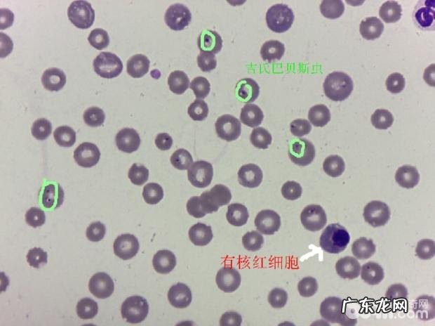 一例犬吉氏巴贝氏虫病例分析