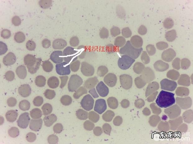 一例犬吉氏巴贝氏虫病例分析