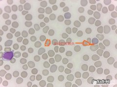 一例犬吉氏巴贝氏虫病例分析