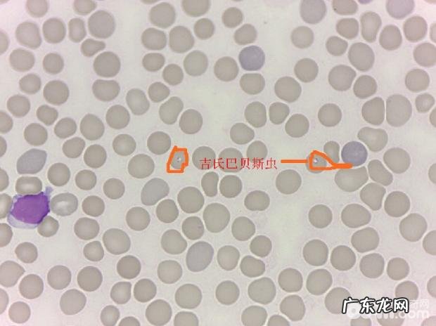 一例犬吉氏巴贝氏虫病例分析