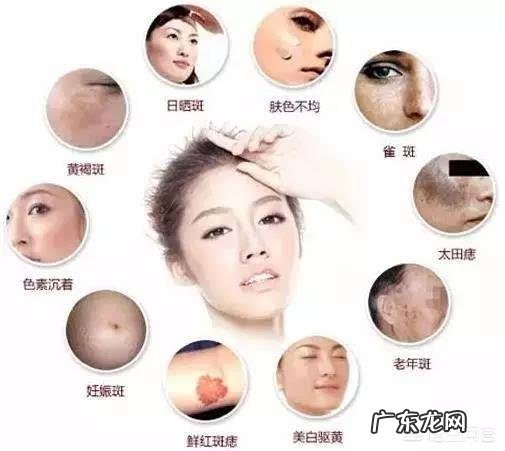 如何祛除老年斑和黄褐斑?