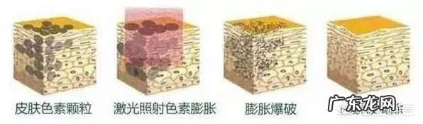 如何祛除老年斑和黄褐斑?