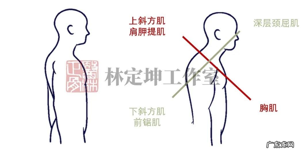 背背佳有用吗?小孩有点驼背怎么矫正?