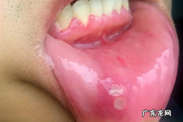 电热毯辐射有多大？电热毯断电后对孕妇有辐射吗？