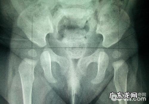 德国牧羊犬的常见遗传病有什么