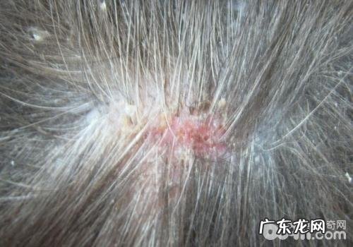 如何防止犬念珠菌性皮肤疾病发作