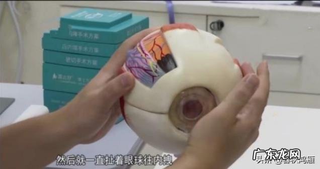 东莞一男孩疯狂玩游戏玩出了“斗鸡眼”进医院,到底是怎么回事