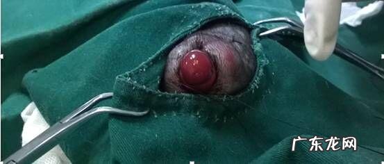 一例创伤造成的目光滑脱