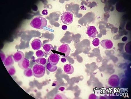 犬感染性性传播疾病肿瘤的症状及医治