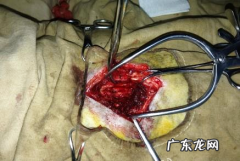 犬腰椎间盘疾病的治疗